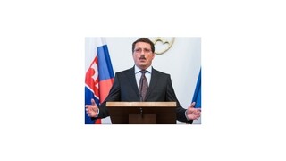 Paška podáva pre kauzu CT prístroja trestné oznámenie, vo funkcii zostane
