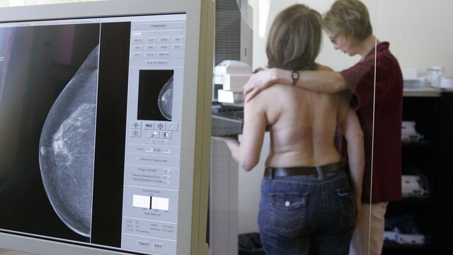 Rakovina prsníka screaning skríning vyšetrenie žena lekár 