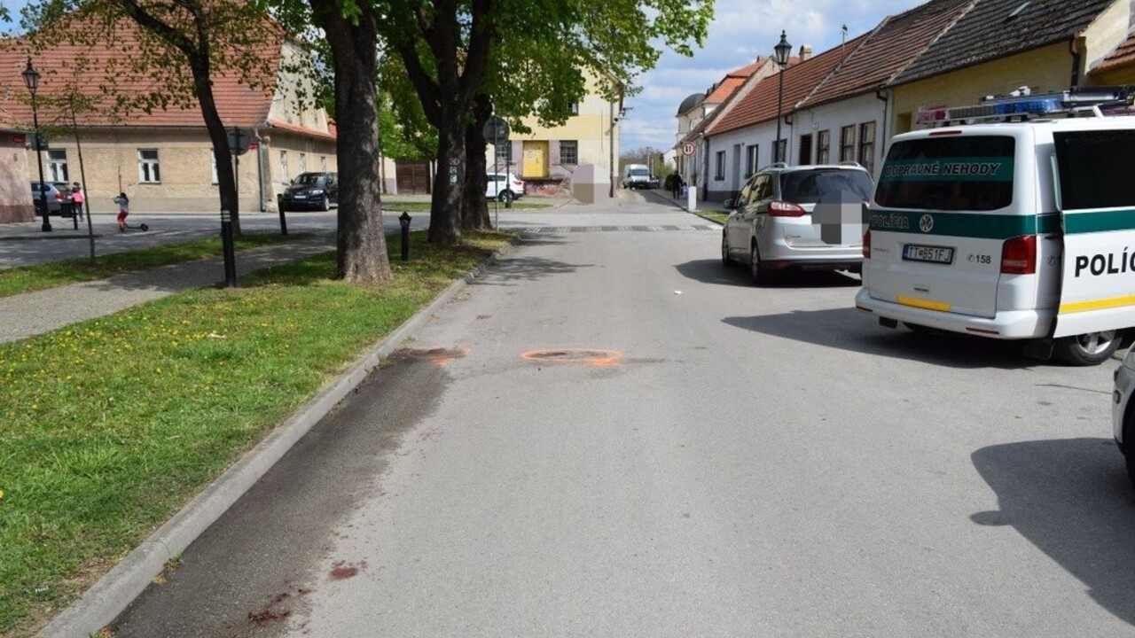 Tragická nehoda. Žena po páde z bicykla zraneniam podľahla