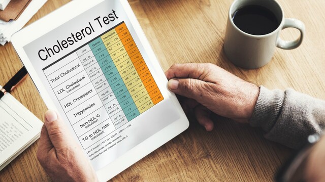 cholesterol